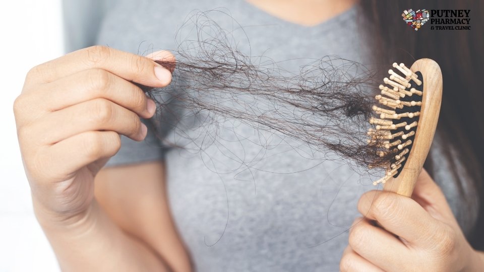 hair loss clinic putney